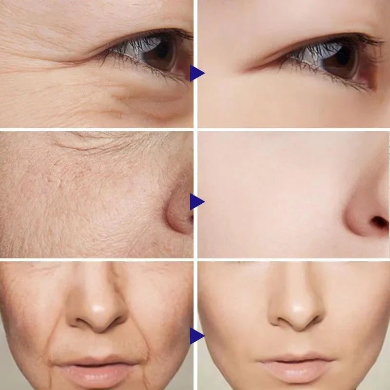 Instant Wrinkle Remover Cream, Anti-Fine Lines, Aging Reduction, Retinol Care, Lifting Effect image 3