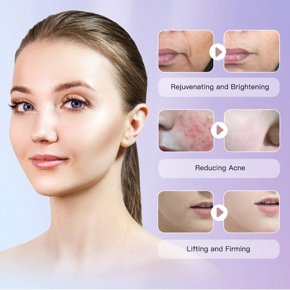 Mini Hifu 4 Original Ultrasonic Micro-Focus 2 Ultrasonic Knife For Anti-Aging Massage image 2